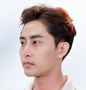 Khách hàng nam trước khi thực hiện thẩm mỹ