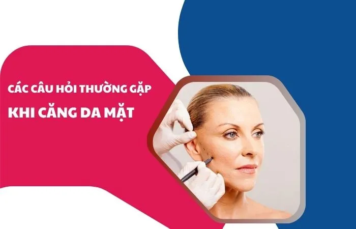Các câu hỏi thường gặp khi căng da mặt