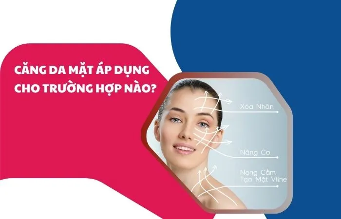 Căng da áp dụng cho các trường hợp nào