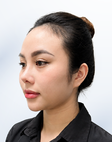 Kim Ngân sau điều trị