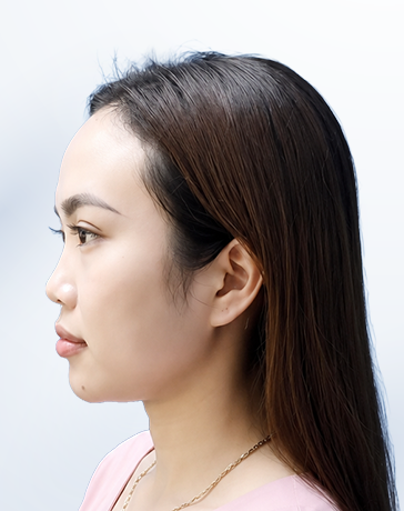 Kim Ngân trước trị liệu