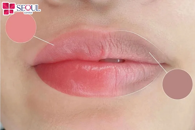 Nếu nền môi thâm, hãy khử thâm trước