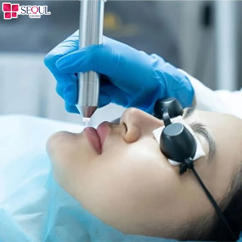 Khử thâm trước là điều cần thiết để môi lên màu đẹp nhất