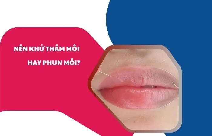 nên khử thâm môi hay phun môi