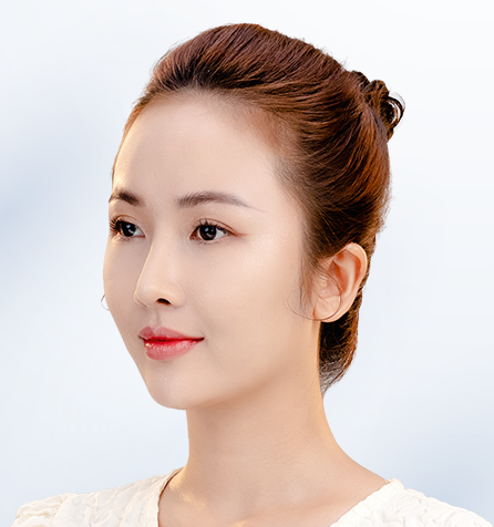 Khách hàng sau thực hiện góc nghiêng
