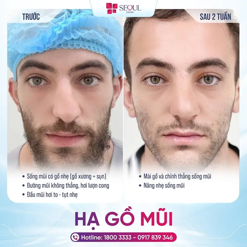 Hiện nay có nhiều khách hàng chọn Việt Nam làm điểm đến du lịch và thẩm mỹ