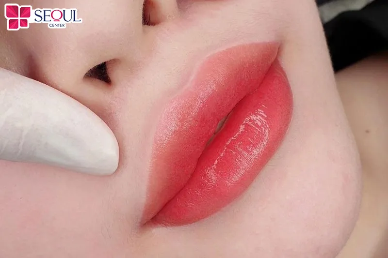 Sau phun môi khoảng 7-14 ngày nếu được chăm sóc đúng cách tình trạng mụn nước sẽ nhanh khỏi
