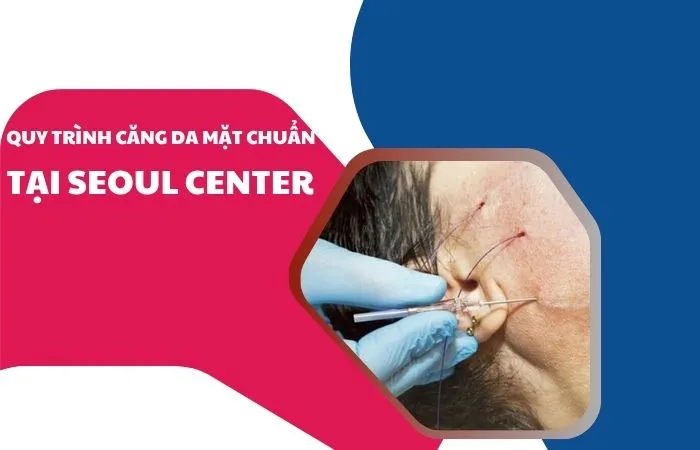 Quy trình căng da mặt chuẩn tại Seoul Center