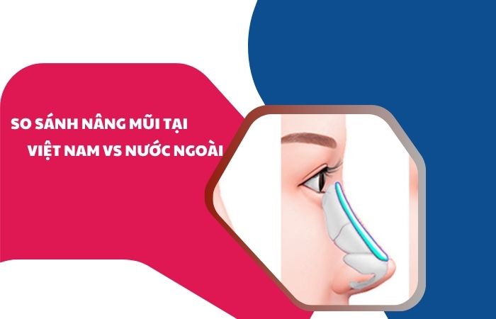 So sánh nâng mũi tại việt nam và nước ngoài