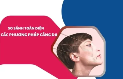 So sánh toàn diện các phương pháp căng da