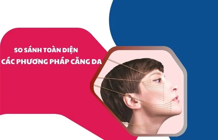 So sánh toàn diện các phương pháp căng da