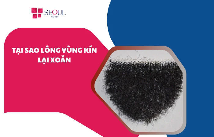 Tại sao lông vùng kín lại xoăn? Cách xử lý hiệu quả