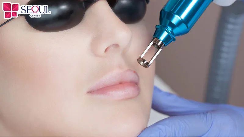 Sử dụng công nghệ ánh sáng sinh học để khử thâm viền môi