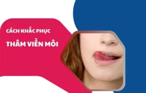 Thâm viền môi