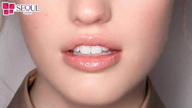 Sau khi bong môi chưa lên màu môi, nó cần một thời gian mới có thể lên màu chuẩn