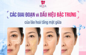 Các giai đoạn và dấu hiệu đặc trưng của lão hoá tầng mặt giữa