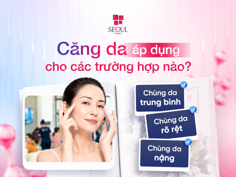 Căng da áp dụng cho các trường hợp nào