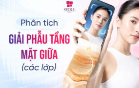 Phân tích giải phẫu tầng mặt giữa (các lớp)