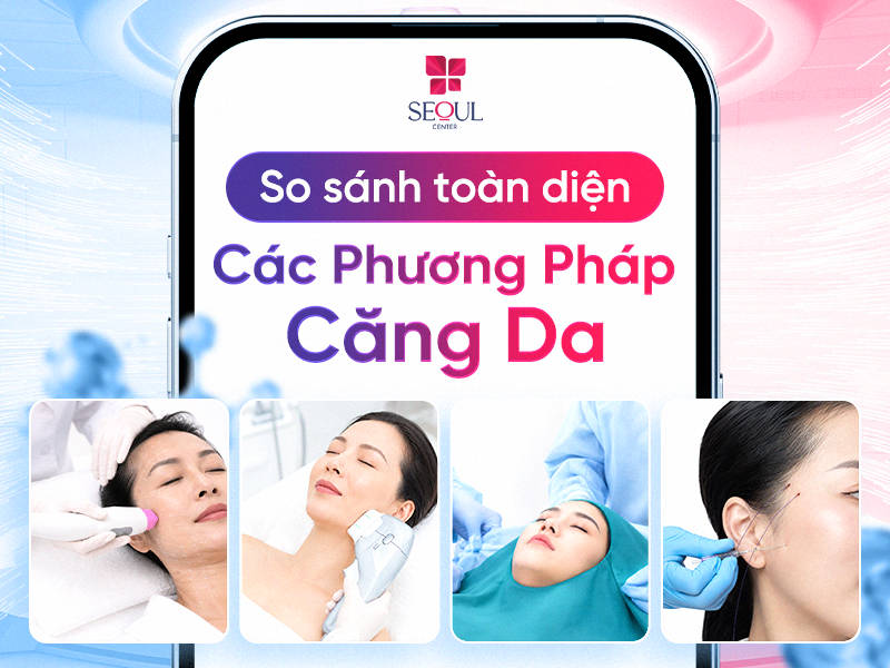 So sánh toàn diện các phương pháp căng da