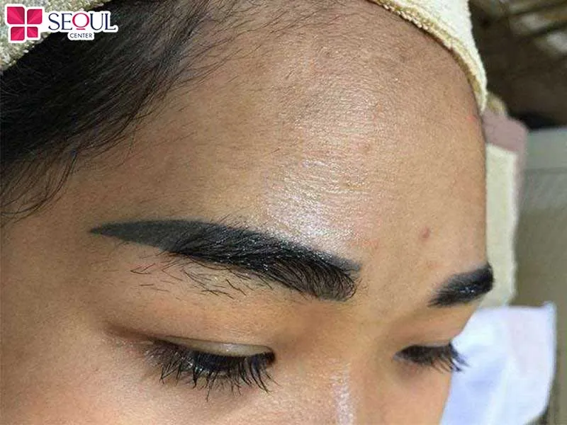 Chân mày sau xăm lên màu quá đậm, hoặc chỗ đậm chỗ nhạt gây mất thẩm mỹ