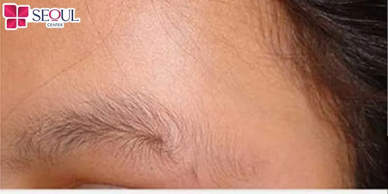 Người có lông mày ngắn xoắn thường là người khá nóng nảy, cộc cằn, dễ gặp khó khăn trong sự nghiệp