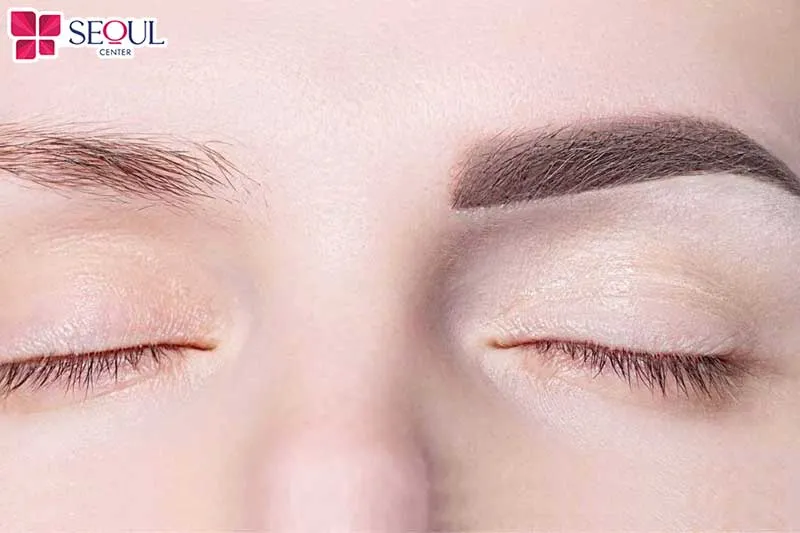 Quy trình phun mày tán bột được thực hiện theo quy trình chuẩn y khoa