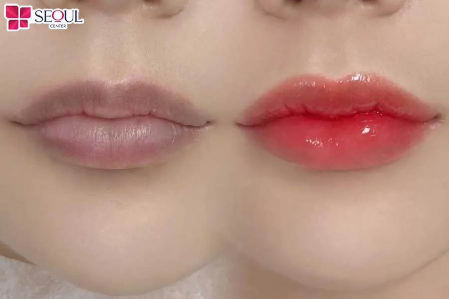 Phun môi màu đỏ tươi giúp khắc phục nhiều khuyết điểm môi
