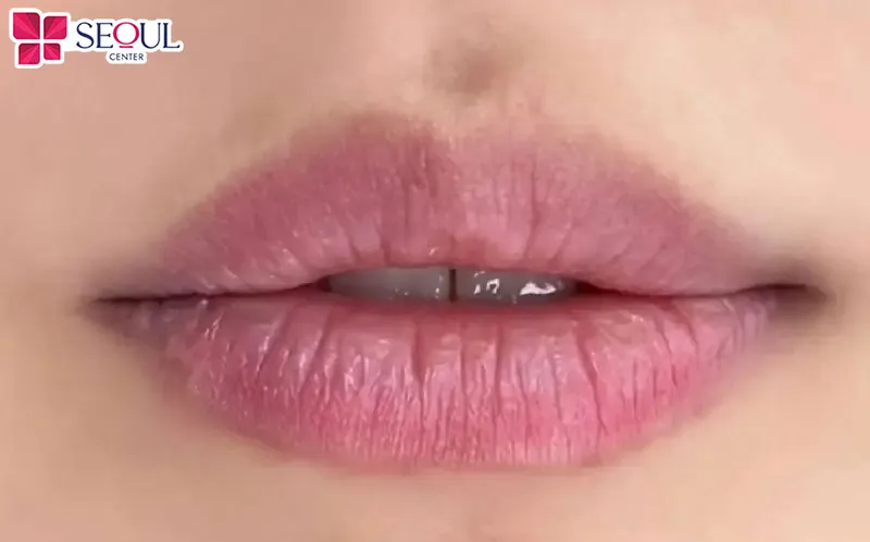 Môi đã qua giai đoạn lên màu sau phun môi lần 2 nhưng vẫn không lên màu