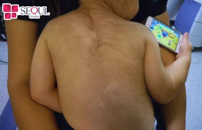 Trẻ em có xoáy lông ở lưng thông minh, nhanh nhẹn và học tập tốt