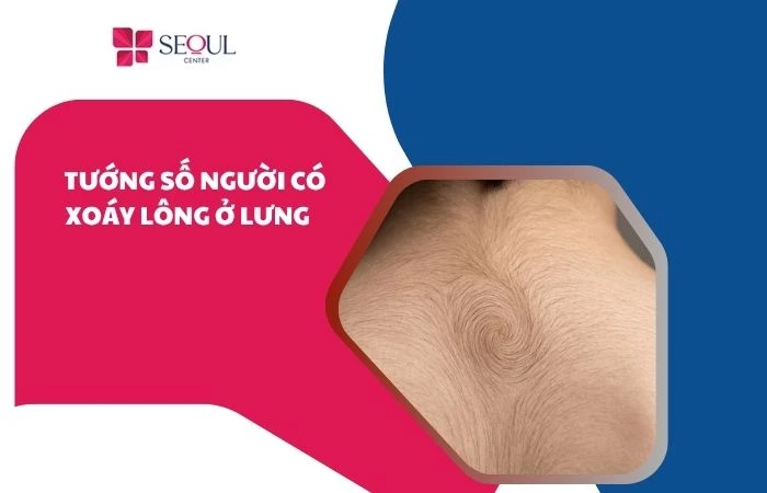 Tướng số người có xoáy lông ở lưng về vận mệnh và tính cách 
