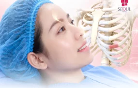 Nâng mũi sụn tự thân