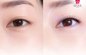Phun mí mở tròng