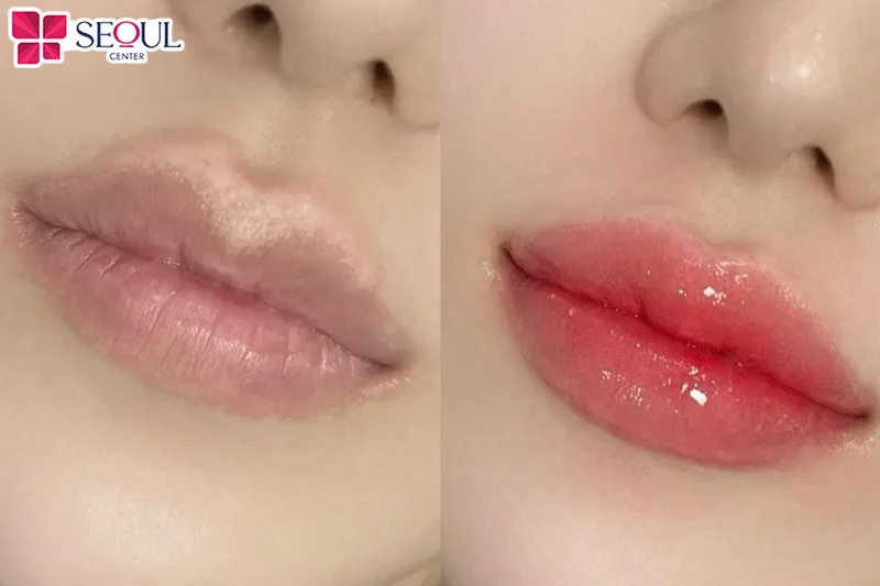 Hiệu quả sau khử thâm môi khiến khách hàng vô cùng hài lòng