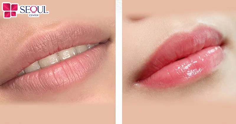 Khách hàng vô cùng ứng ý về độ tự nhiên và sắc hồng dịu nhẹ sau khử thâm môi