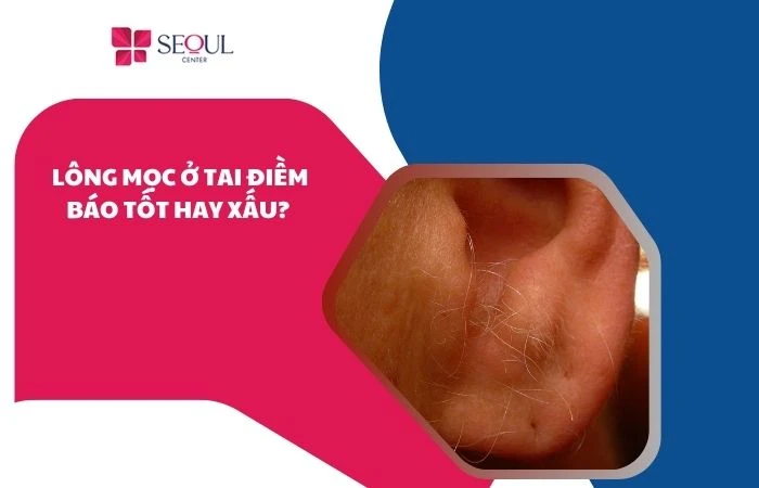 Lông mọc ở tai điềm báo tốt hay xấu? Về vận mệnh và tiền tài