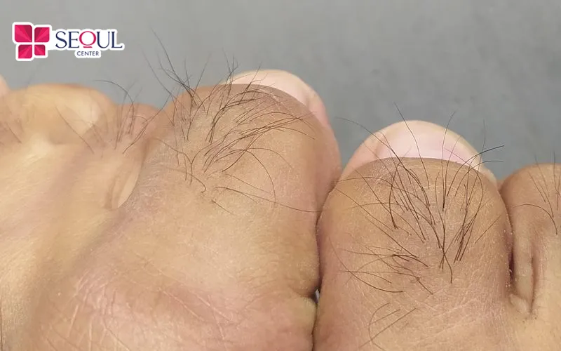 Nam giới có lông ngón chân cái thường sở hữu tính cách kiên cường, quyết đoán và được quý nhân phù trợ