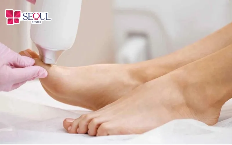 Công nghệ triệt lông laser sở hữu nhiều ưu điểm, đặc biệt là tính hiệu quả và kết quả dài lâu