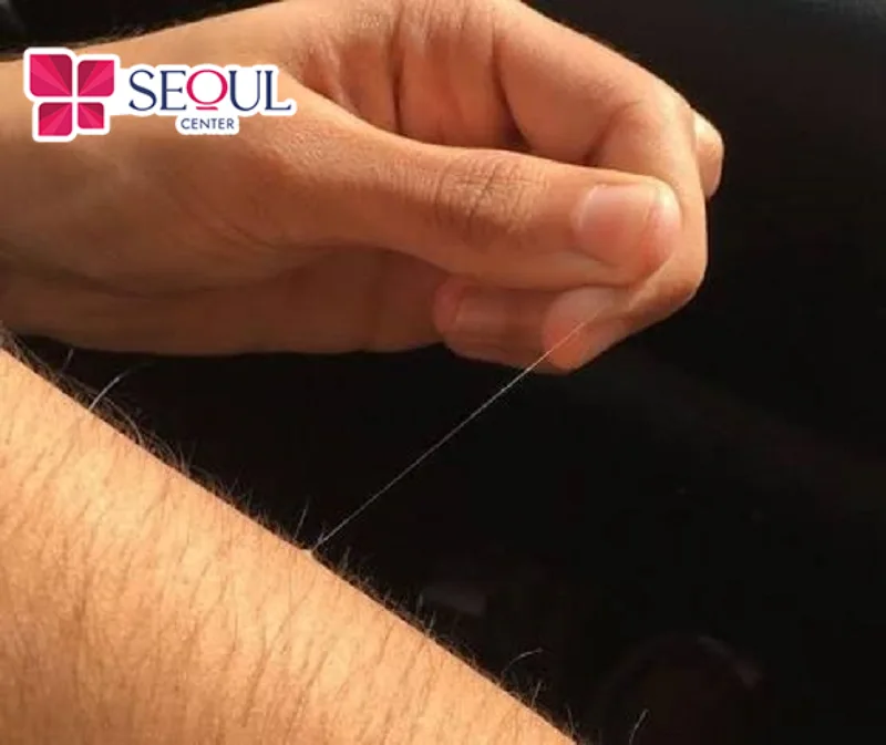 Lông tay màu trắng xuất hiện mang nhiều ý nghĩa đặc biệt trong tướng số