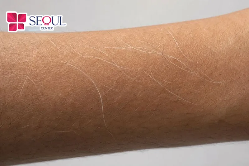 Người sở hữu lông tay màu trắng được xem là vượng khí, mang lại nhiều ý nghĩa tướng số tốt cho người sở hữu