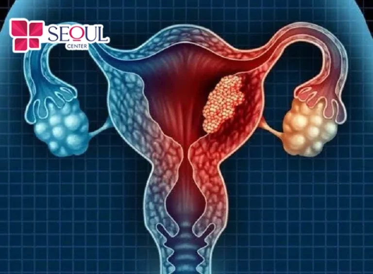 Lông tay màu trắng xuất hiện nhiều có thể là cảnh báo cơ thể đang mắc bệnh về buồng trứng