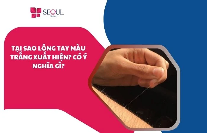Tại sao lông tay màu trắng xuất hiện? Có ý nghĩa gì?