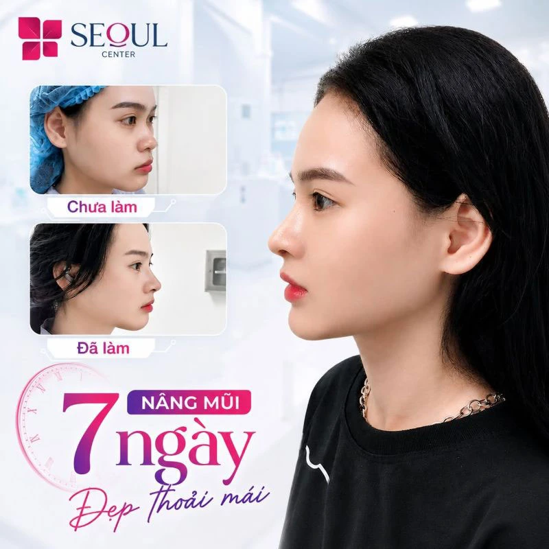 Tuân thủ chế độ chăm sóc hậu phẫu giúp mũi nhanh ổn định và đẹp tự nhiên