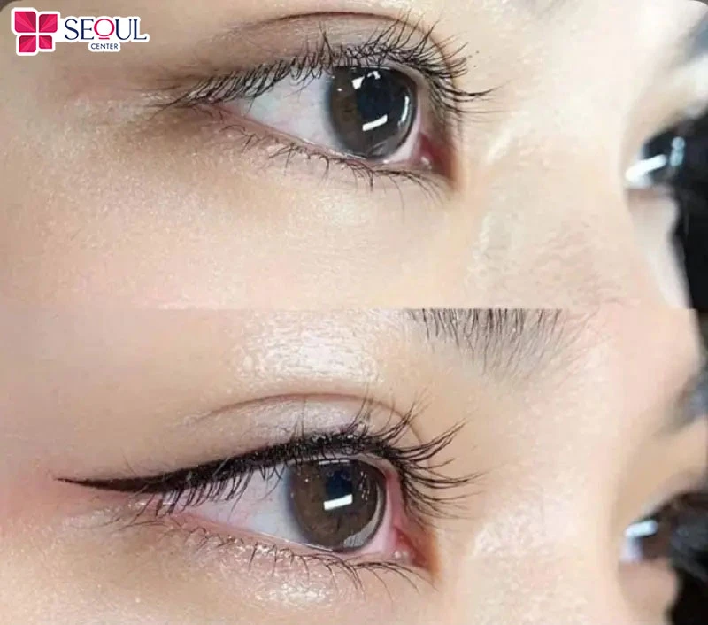 Phun mí mở tròng đá đuôi giúp tạo đường mí chuẩn xác, phần đuôi đá nhẹ giúp tạo chiều dài cho đuôi mắt, cân đối hài hòa gương mặt