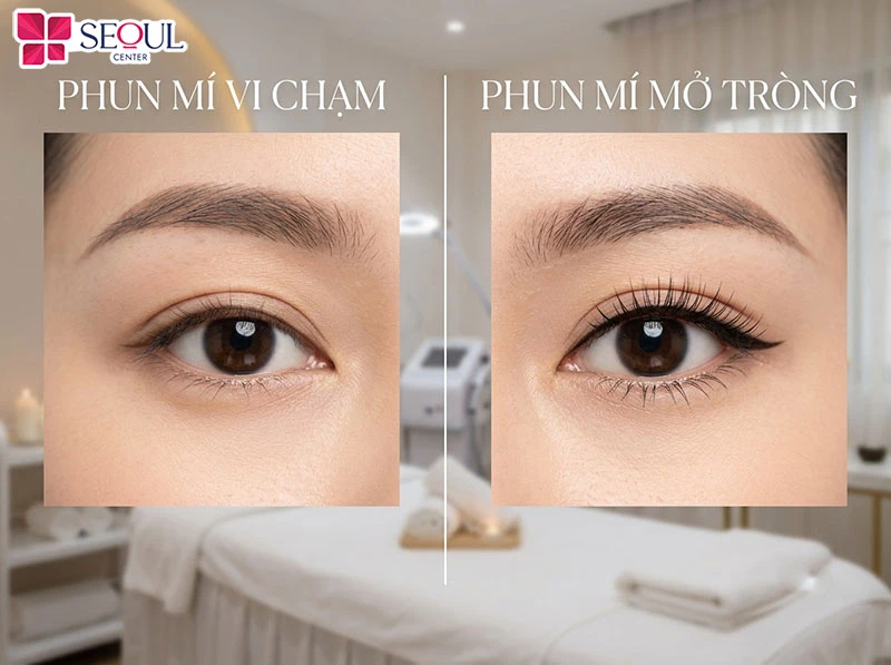 Phun mí mở tròng và vi chạm có sự khác biệt rõ rệt về kỹ thuật