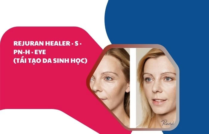 rejuran healer