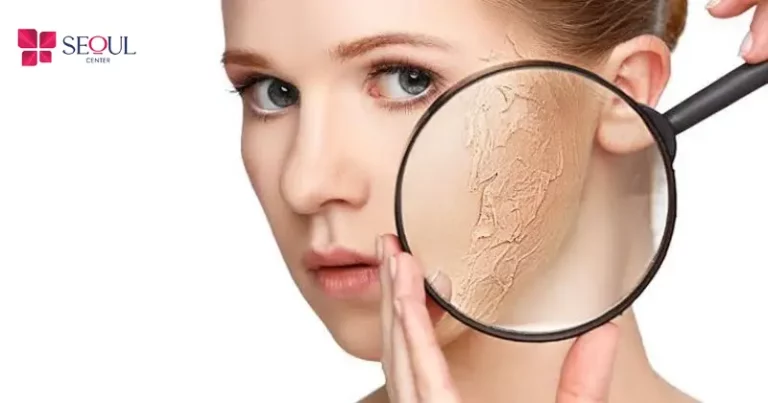 Cần dưỡng ẩm kỹ sau khi triệt để tránh tình trạng da bị khô và bong tróc.