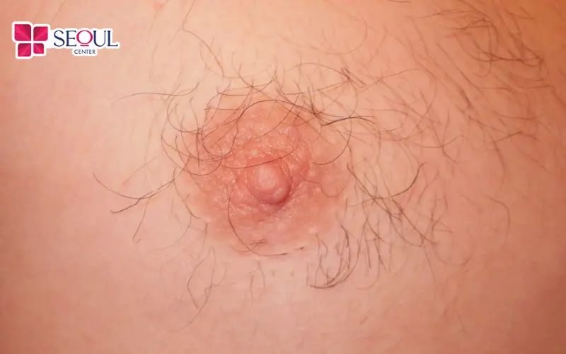 Nam giới mọc lông vú được xem là người có vận khí tốt và giàu sinh lực