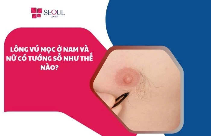 Lông vú mọc ở nam và nữ có tướng số như thế nào?