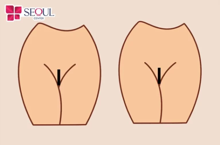 Tạo hình bikini Playboy là kiểu tạo hình tự do theo sở thích của mỗi người