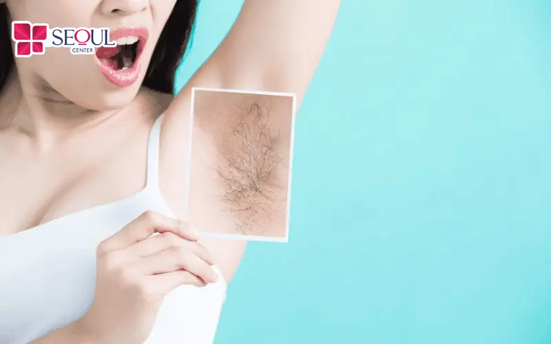 Mẹ bầu sau sinh không nên nhổ lông nách ngay để tránh tổn thương da
